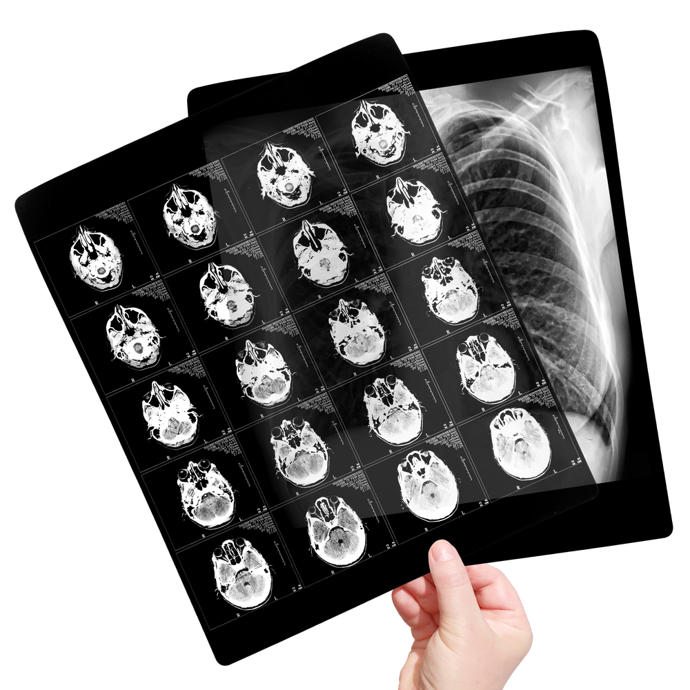 radiologia