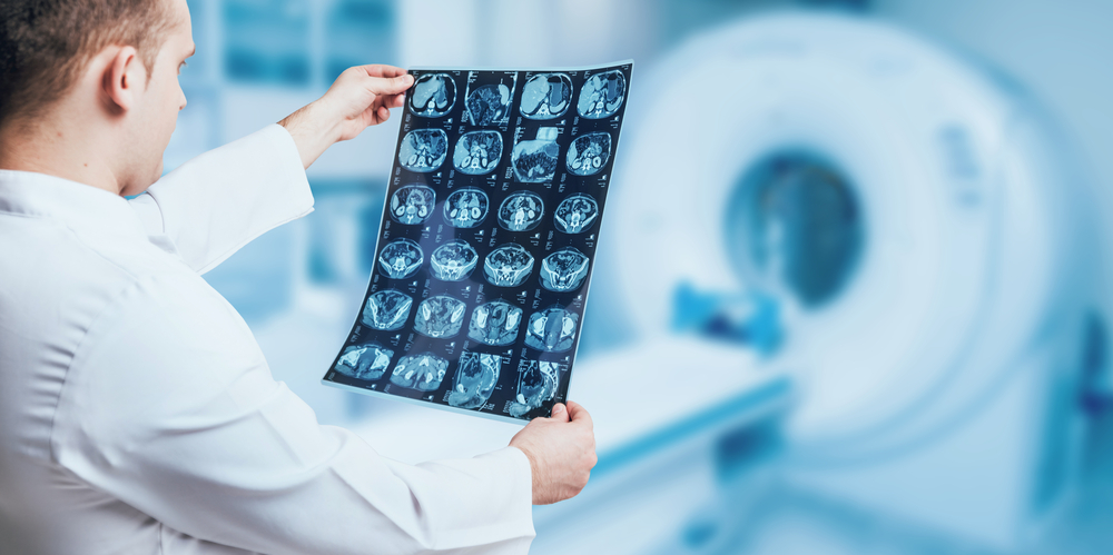 Profissional graduado no curso de Radiologia segurando uma imagem de resultado de exame